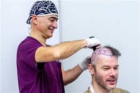 Navigating the World of Haartransplantation Türkei Kosten: Tips and Tricks