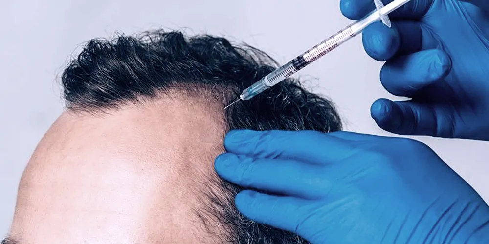 Haarpflege neu gedacht mit hairfiller bei MorySkin